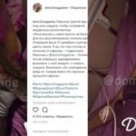 Марина Мексика исправила провалившийся после ринопластики нос
